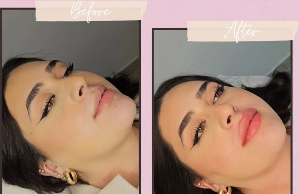 עיצוב שפתיים