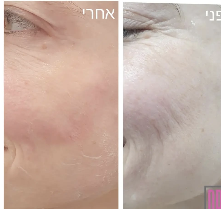 סקין בוסטרס